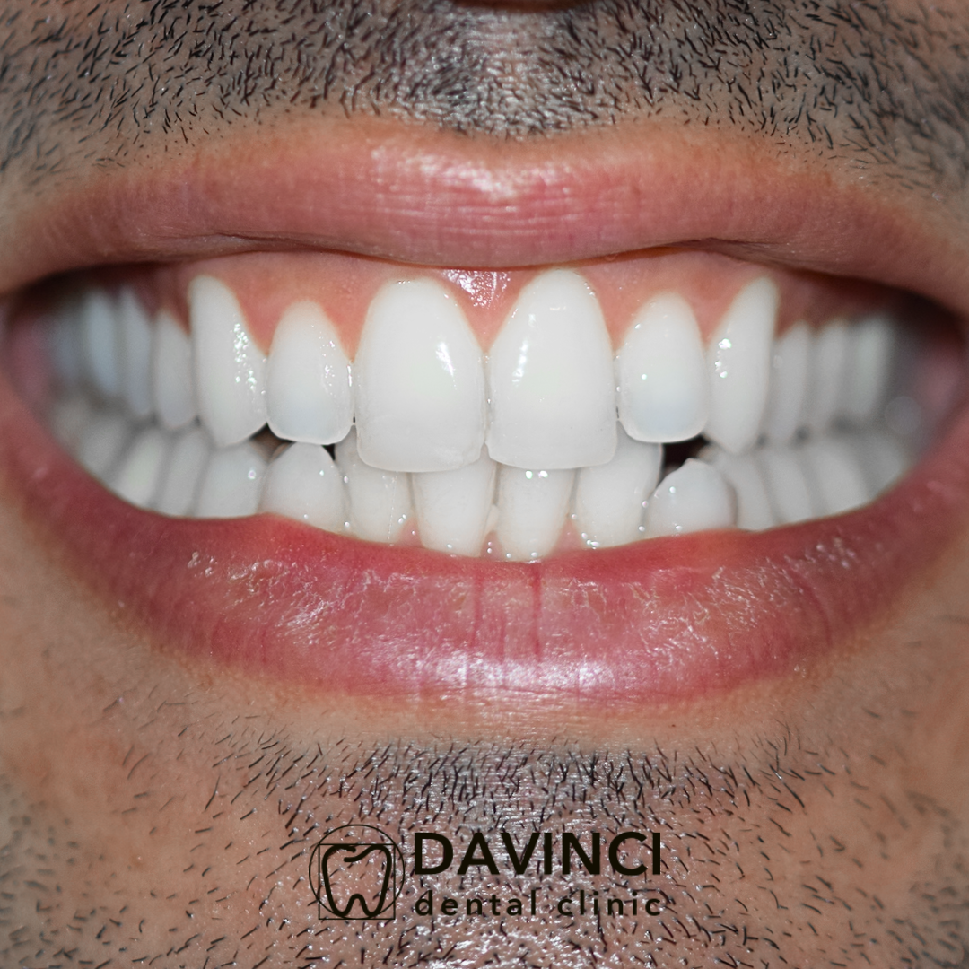 Davinci Dental Clinic Marrakech